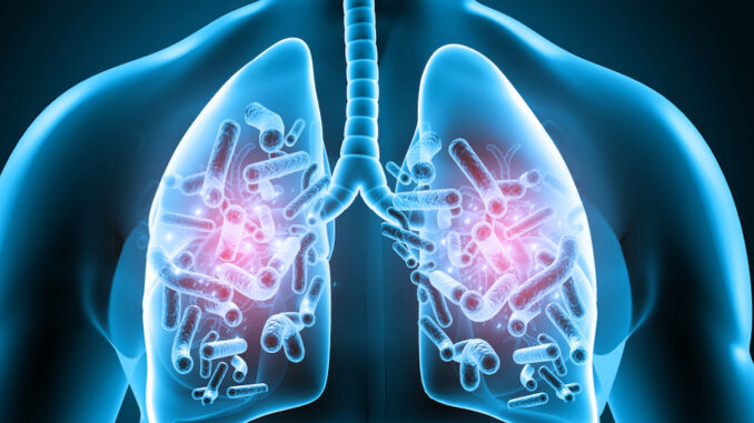 Lung Infection treatment in East Delhi