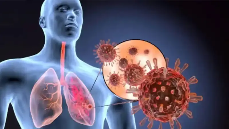 Chest pain Doctor in Greater Noida